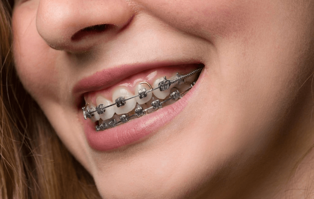 Prevención y limpieza dental