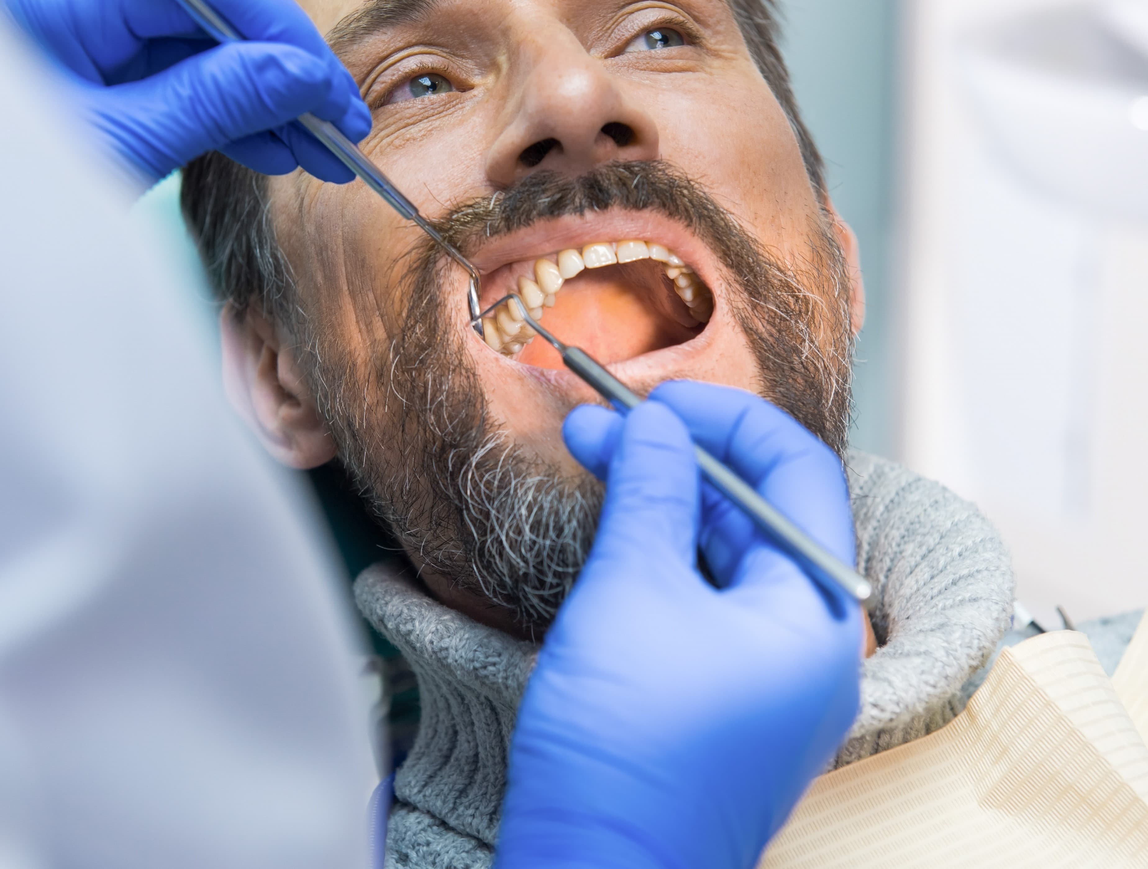 Detección precoz del cáncer oral: el papel del dentista