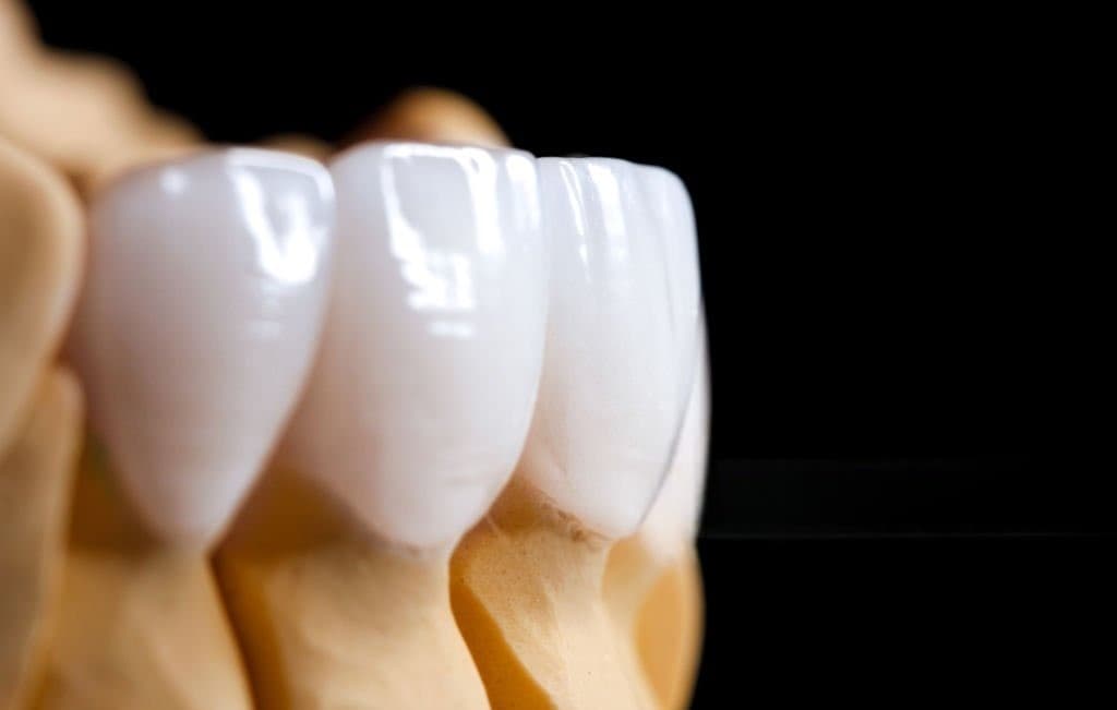 Prótesis dentales