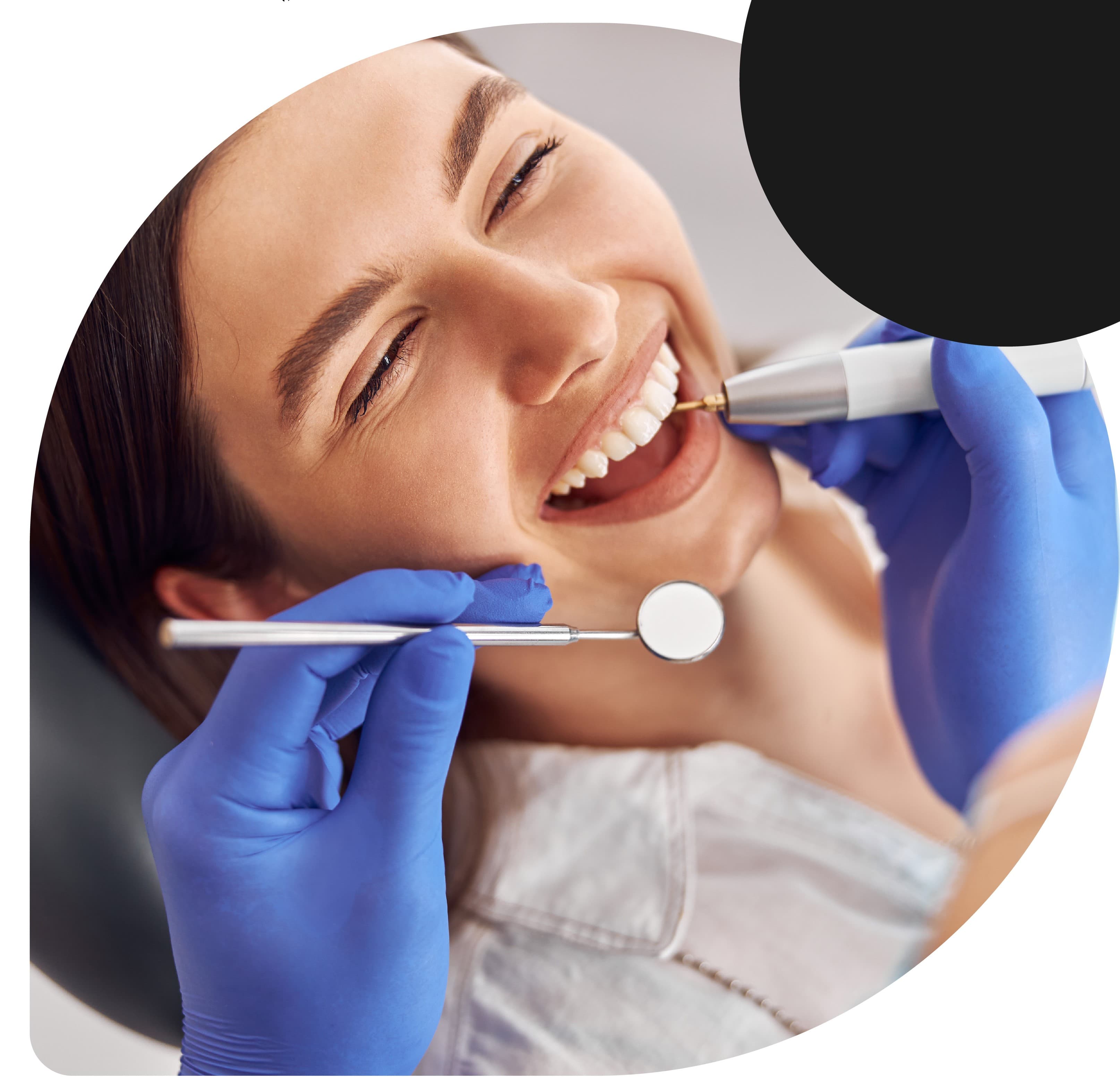 Sarro dental: por qué hay que eliminarlo en la consulta